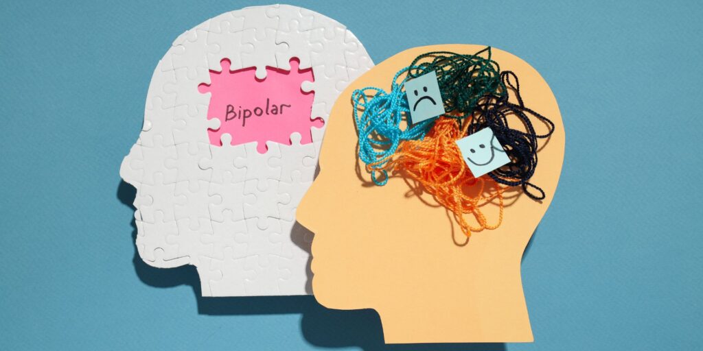 Bipolar II